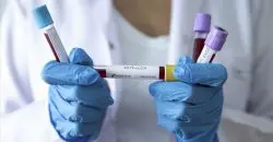 В Украине – очередной антирекорд по Covid-19, в Днепре – 932 новых заболевших - рис. 19