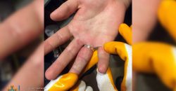 Опасное украшение: в Днепре спасатели сняли перстень с опухшего пальца молодого человека - рис. 7