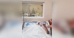 В больнице Мечникова в Днепре спасают украинского бойца с тяжелыми ожогами - рис. 5