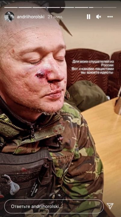 Лидер группы «Бумбокс» Андрей Хлывнюк попал под минометный обстрел - рис. 2