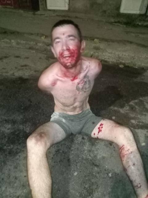 У Дніпрі "герой-коханець" накинувся з ножем на працівника охоронної фірми (Фото) - рис. 2