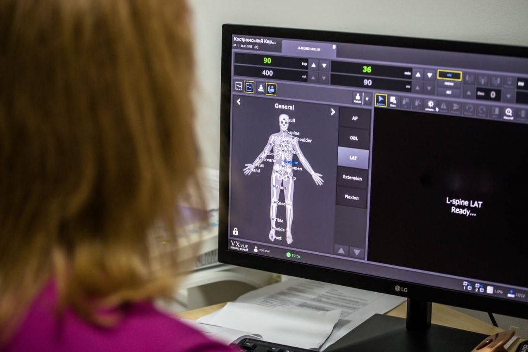 В больнице Днепропетровщины установили современный цифровой рентгенограф - рис. 1