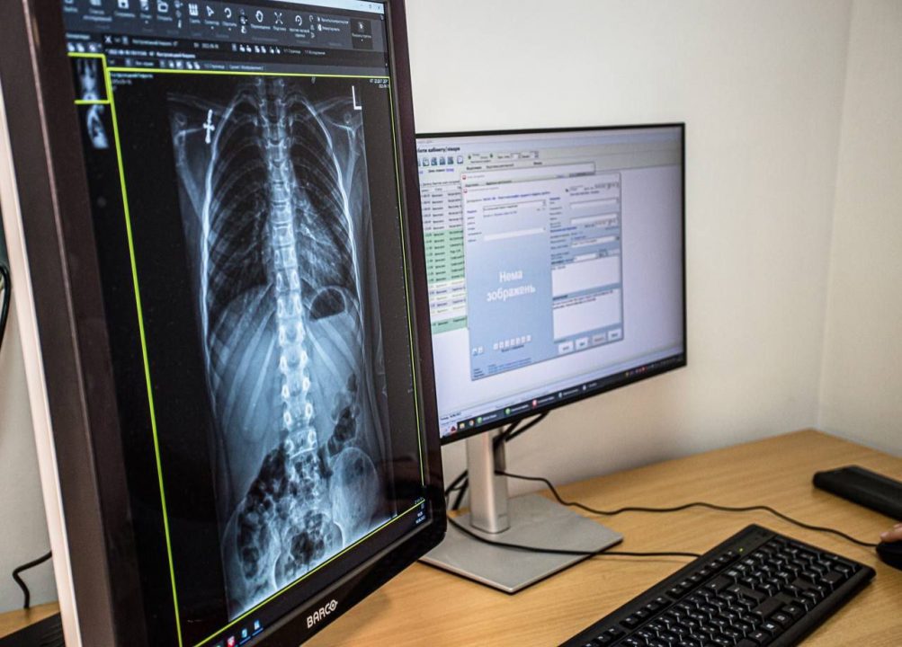 В больнице Днепропетровщины установили современный цифровой рентгенограф - рис. 2