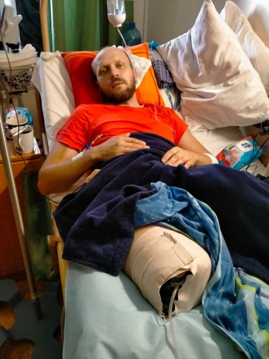 Потрібна допомога: дніпровський фотограф втратив ногу на фронті - рис. 2