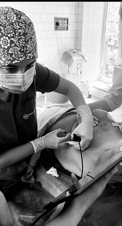 Більше десяти операцій на двох: у Дніпрі в лікарні Мечникова рятують важкопоранених мати та доньку - рис. 1