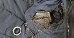 Внаслідок ракетного удару осколкове поранення отримала співробітниця мерії Дніпра - рис. 20