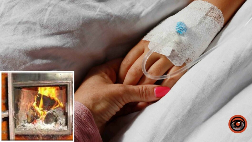 В Днепре спасают 9-летнюю девочку, получившую обширные ожоги тела - рис. 1