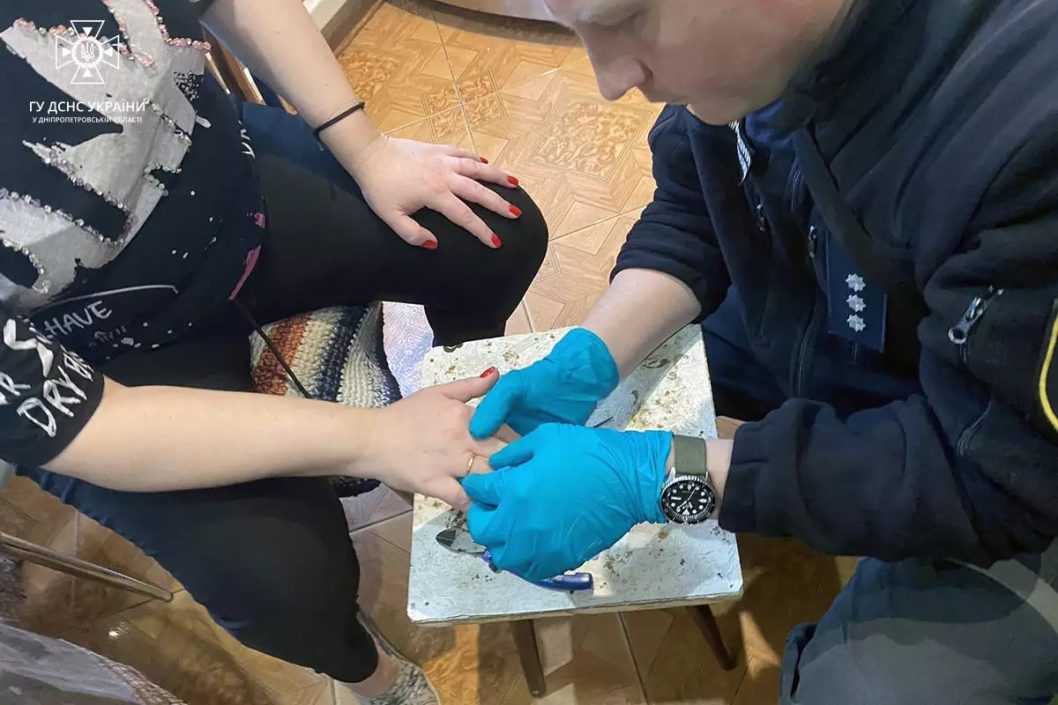У Дніпрі рятувальники допомогли жінці зняти обручку з опухлого пальця