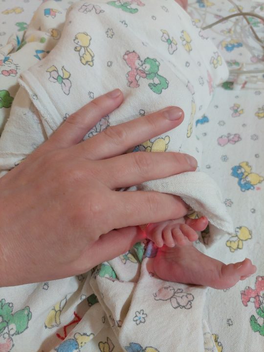 Дніпровські лікарі врятували життя немовляті з вродженою вадою серця - рис. 2