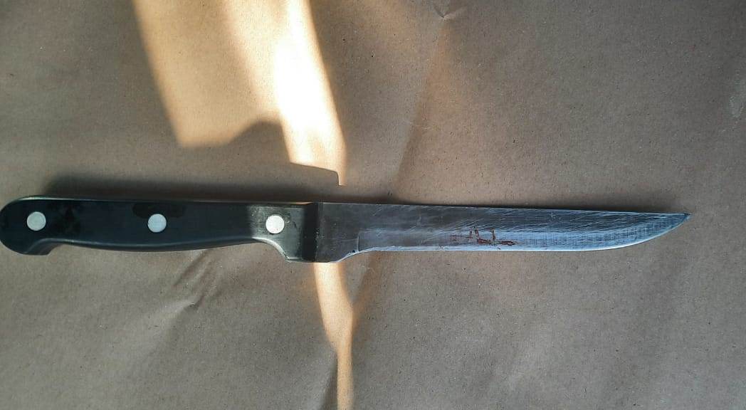 На Дніпропетровщині затримали чоловіка, що встромив дружині ножа у живіт через ревнощі