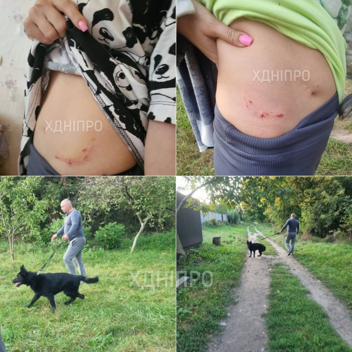 У Дніпрі собака напав людину та намагався покусати іншого пса