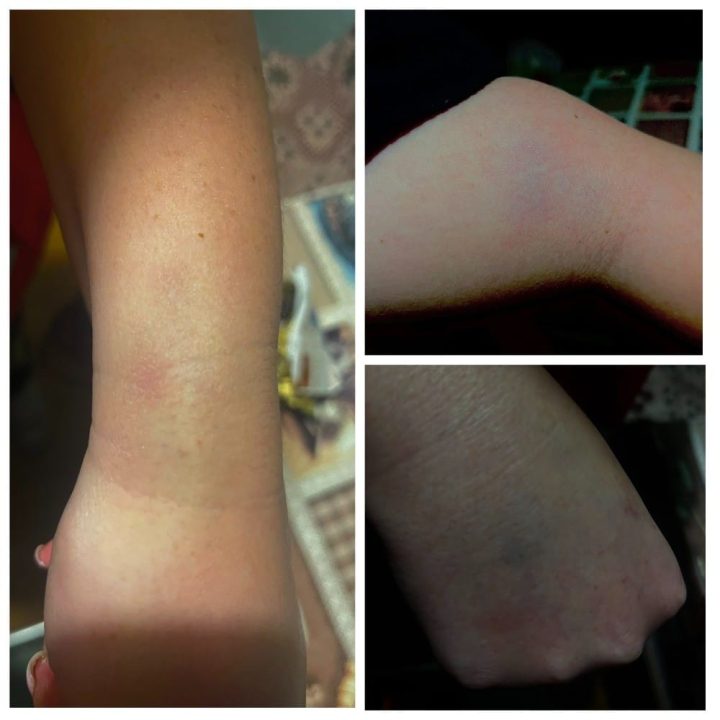 В Днепре нетрезвый мужчина напал на бригаду скорой: медики получили травмы - рис. 1