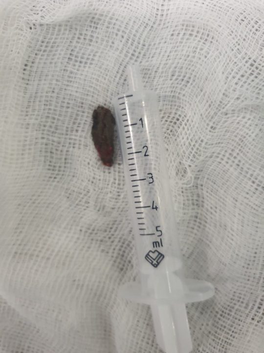 У Дніпрі лікарі врятували бійця з уламком в серці