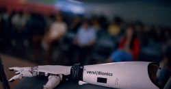 У Дніпрі розробили унікальний протез, який не має аналогів у світі - рис. 3