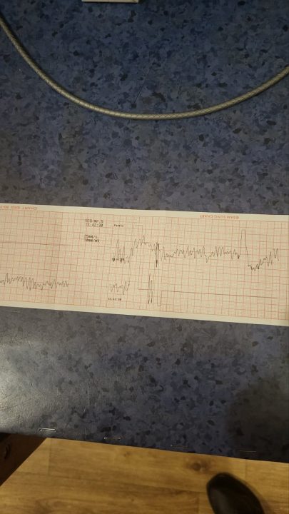 В Днепре "скорая" спасла мужчину в состоянии клинической смерти - рис. 2