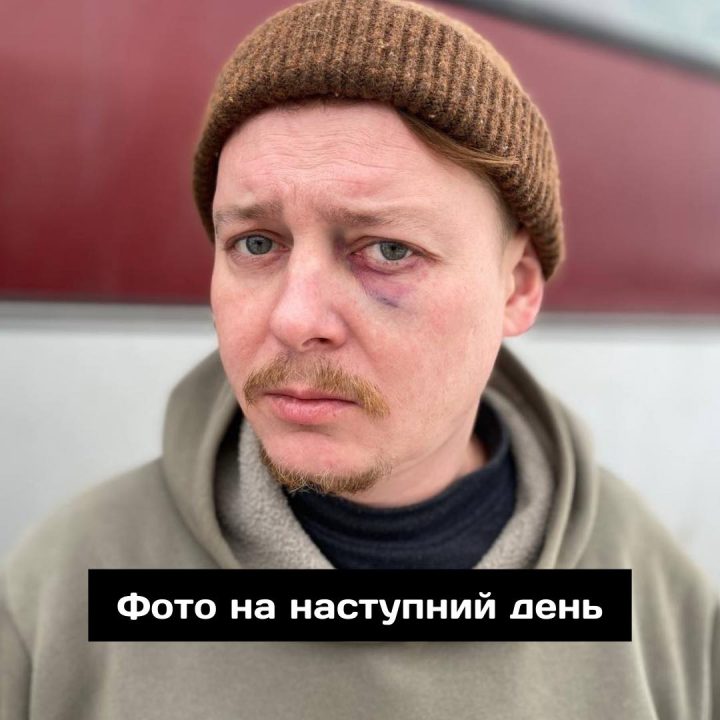 У Дніпрі директор театру відлупцював актора під час вигрузки костюмів