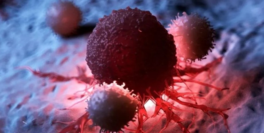 Вчені знайшли альтернативний спосіб лікування раку сечового міхура