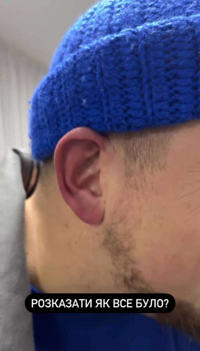 У Дніпрі під час концерту глядач влаштував бійку та побив коміка