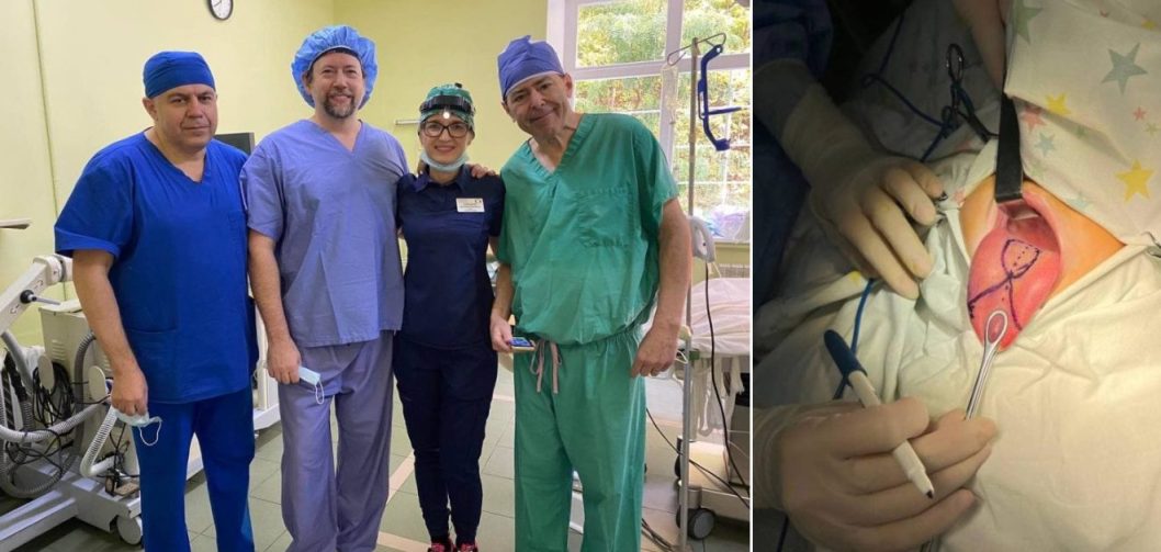 В Україні вперше прооперували малюка з уп'ятеро довшим за норму язиком