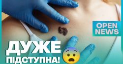 Медики Дніпра розповіли, як мешканцям вберегтися від меланоми - рис. 10