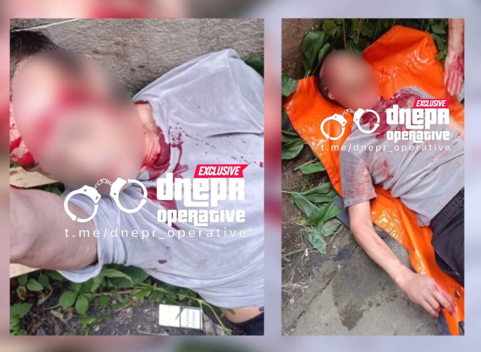 В Днепре скончался мужчина, которому в голову выстрелил 17-летний парень - рис. 1
