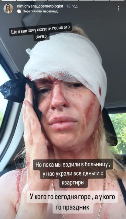 У Кривому Розі пограбували квартиру постраждалої жінки, поки вона була у лікарні