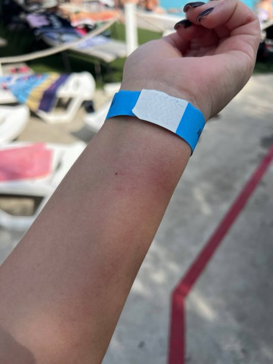 Дніпряни скаржаться на подразнення шкіри після купання в аквапарку