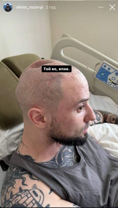 Зірка "Ліги сміху" Розовий вперше показав наслідки важкого поранення на фронті - рис. 1