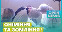 Інсульт «помолодшав» на 10-15 років: як мешканцям уникнути порушення мозкового кровообігу