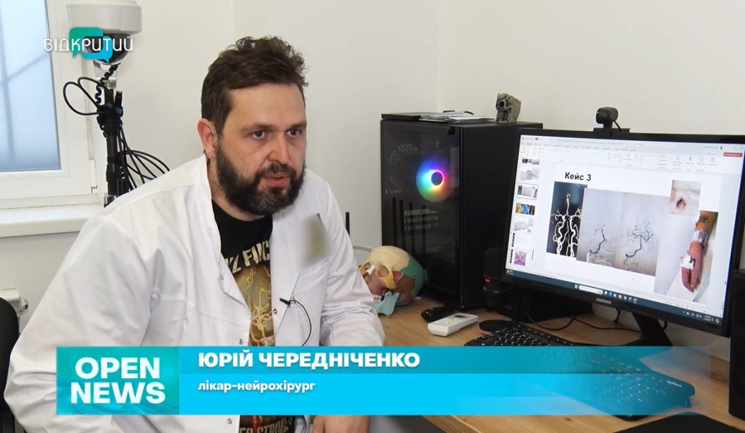 Інсульт «помолодшав» на 10-15 років: як мешканцям уникнути порушення мозкового кровообігу