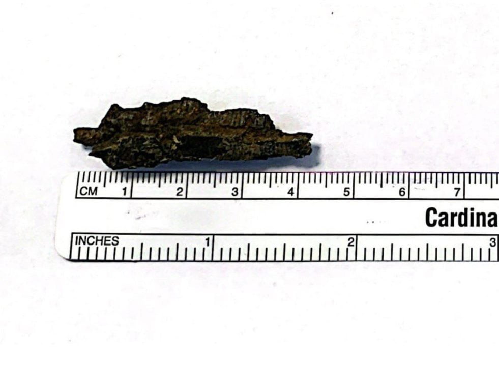 Уламок уразив мозок: у Дніпрі рятують 51-річного воїна, який отримав поранення на Донеччині - рис. 1