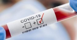 Заболеваемость COVID-19 в Украине выросла в шесть раз в июле, но эпидсезон еще не начался - рис. 7