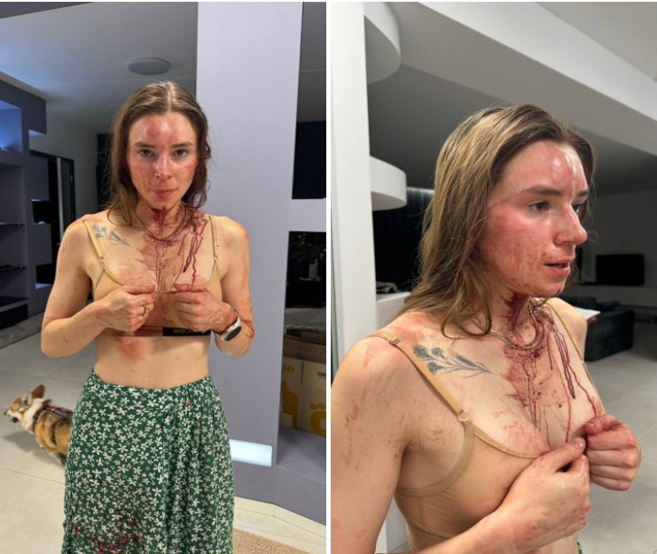 У Дніпрі затримали хуліганів, які напали на активістку  - рис. 1