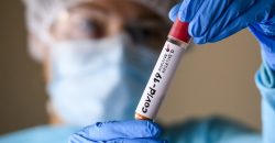 На Днепропетровщине от COVID-19 умерли два человека - рис. 20